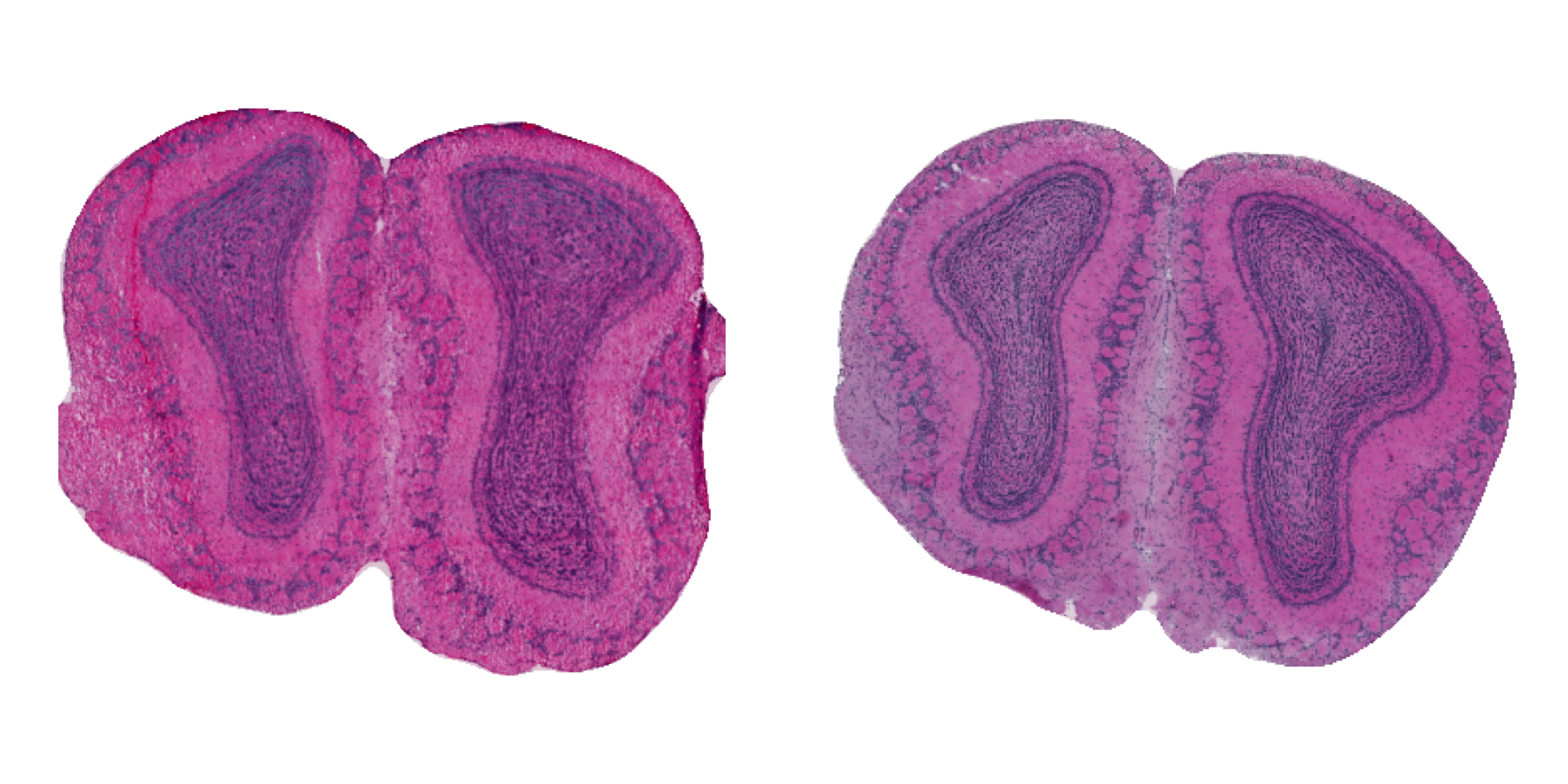 Processed H&E images
