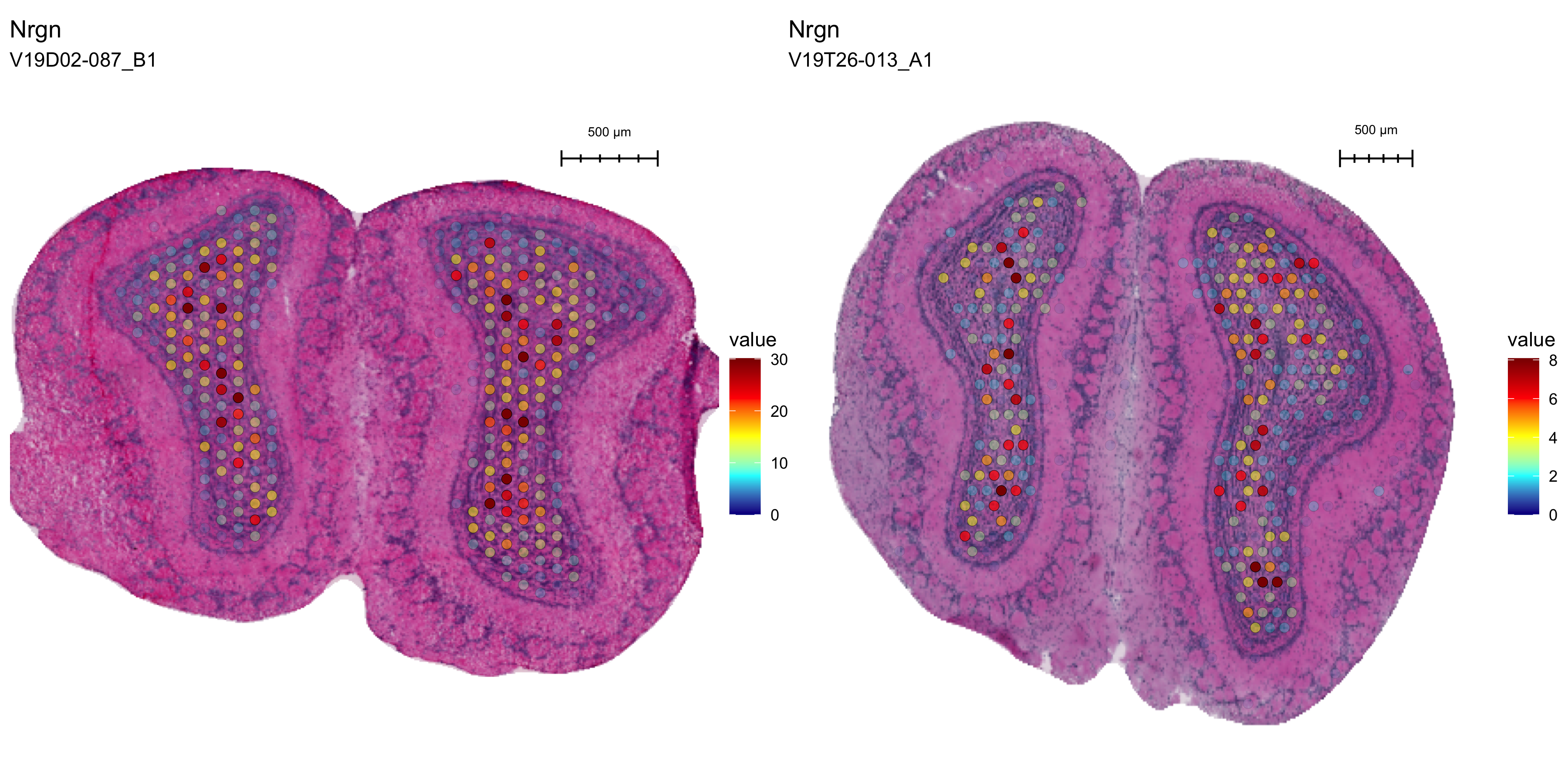 Spatial distribution of Nrgn