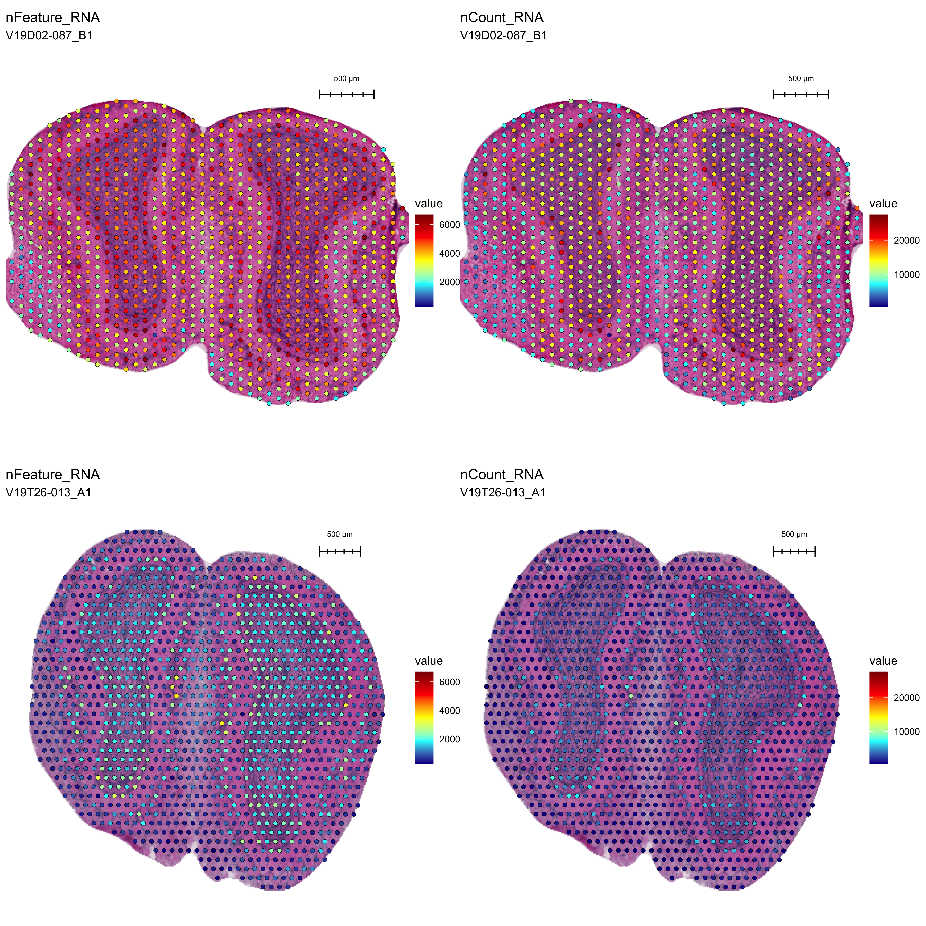 Spatial QC metrics overlay. nFeature_RNA = unique genes; nCount_RNA = UMI count